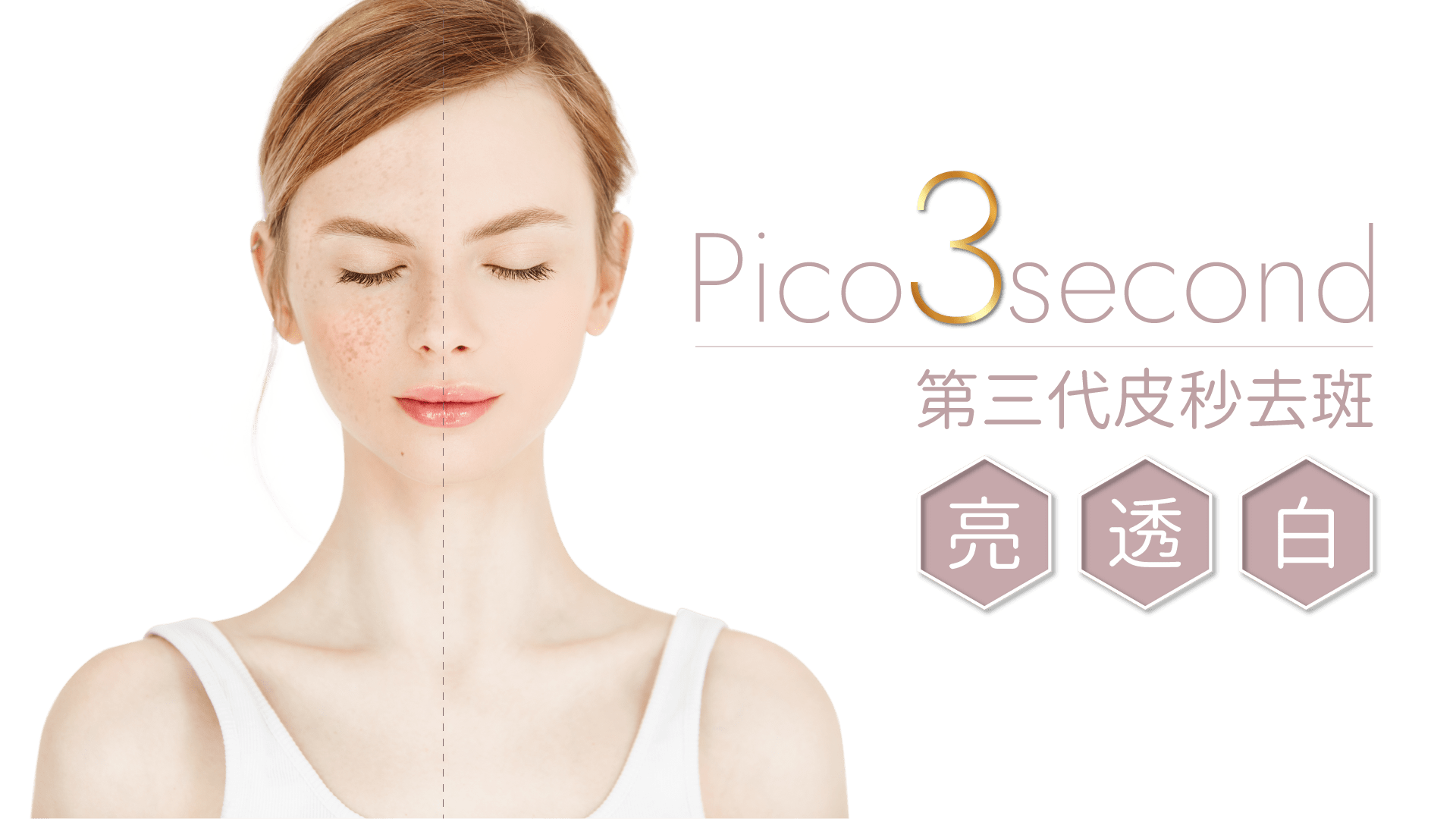 pico3second第三代皮秒去斑
